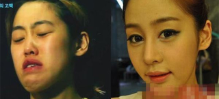 Illustration for article titled Oh god, Korean plastic surgery will never cease to amaze me